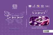 معرفی کتابچه «آنچه باید درمورد بیماری لوپوس بدانیم»